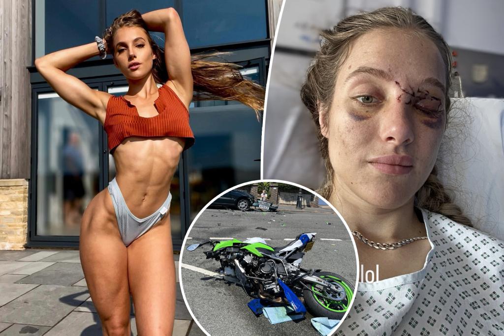 OnlyFans model Mercedes Valentine suffers memory loss after crash