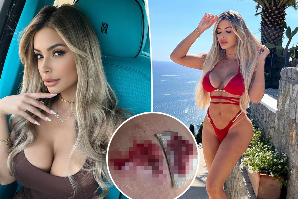 Model warns of long side effects from K ‘beauty chip’ to look hotter