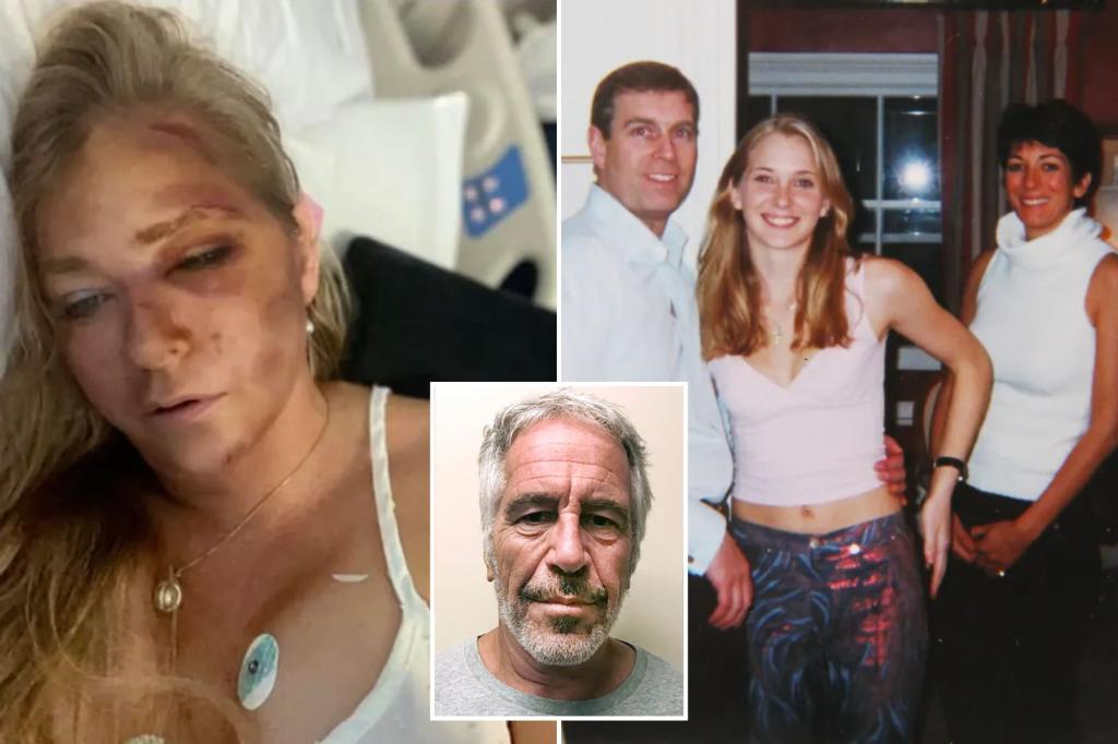 Jeffrey Epstein accuser Virginia Giuffre says she has just days left to live after getting hit by school bus