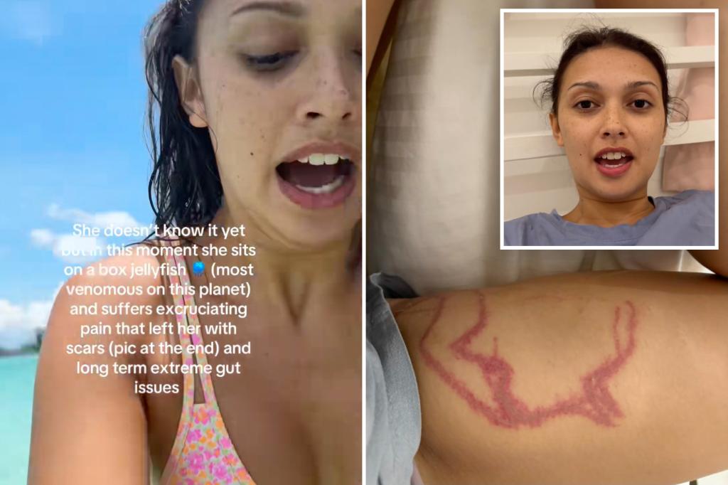 Moment influencer inadvertently films herself getting stung by deadly box jellyfish