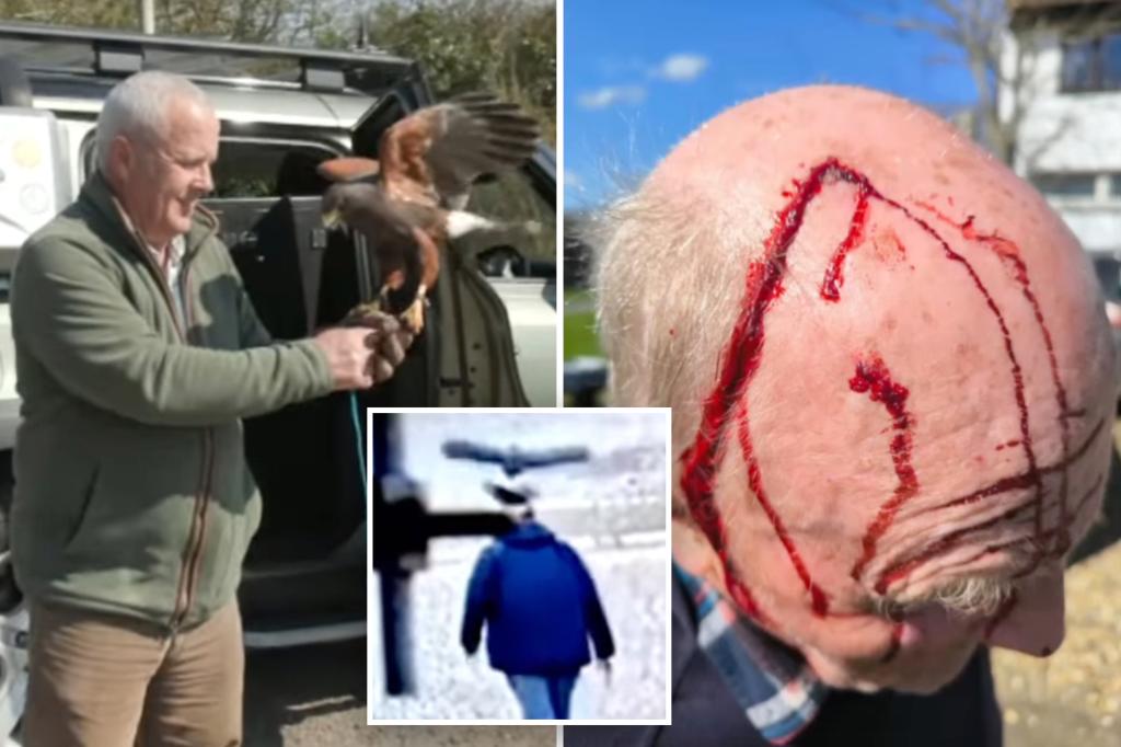 ‘Hormonal’ hawk terrorizes bald men for weeks in English village
