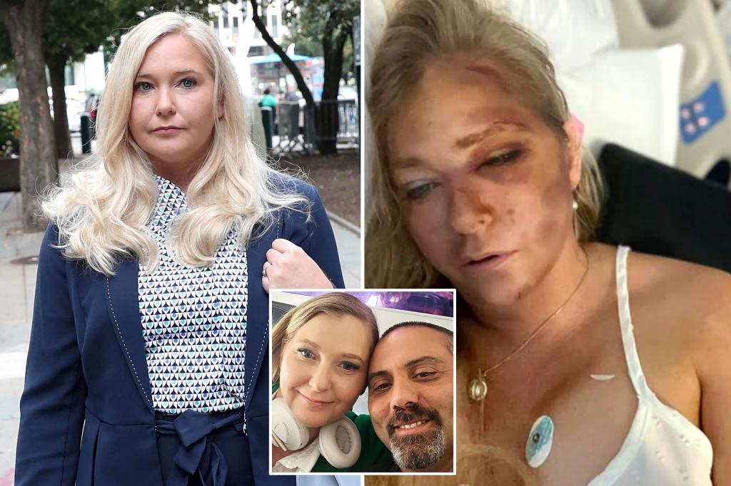 Epstein accuser Virginia Giuffre claims to be victim of domestic violence at hands of her husband: report