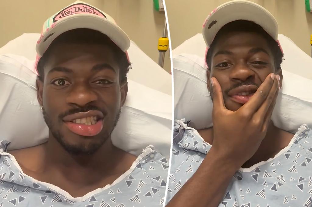 Lil Nas X hospitalized for partial paralysis on his face