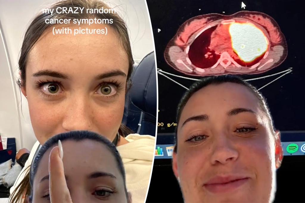 Gen Zer shares ‘crazy random cancer symptoms’ docs dismissed