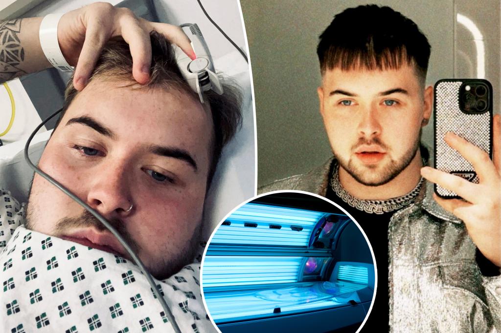 I went to the tanning bed five times a week — now I have just a year to live