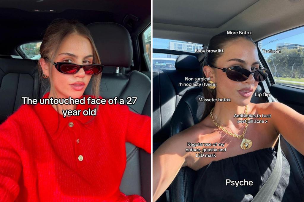 Gen Z is obsessed with ‘tweakments’ — plastic surgery to look ‘natural’