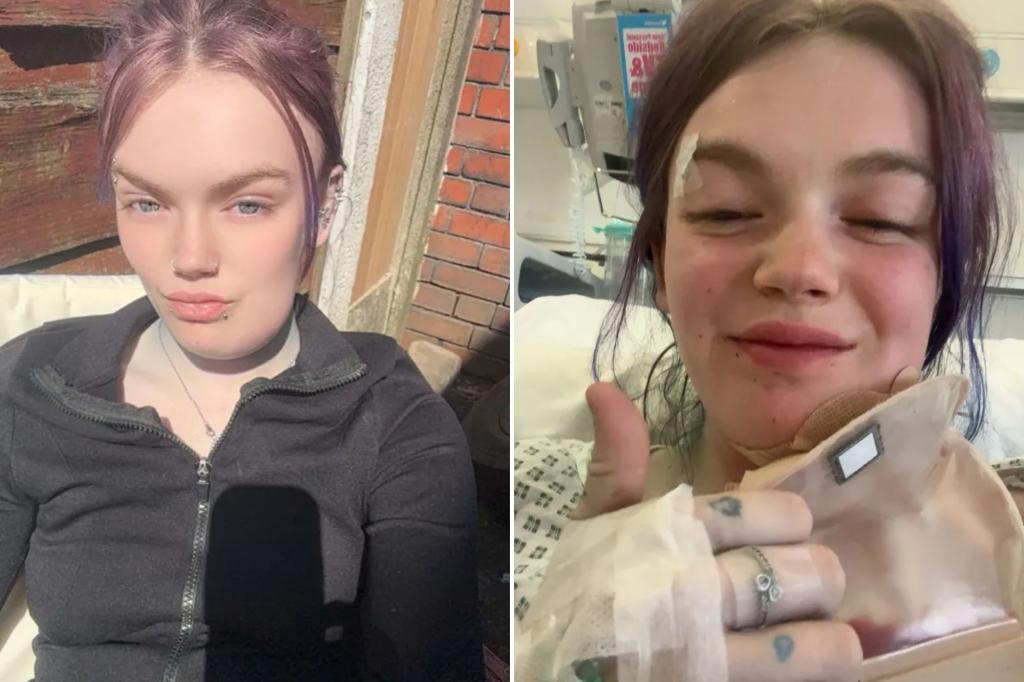 I cracked my tooth — then it nearly killed me