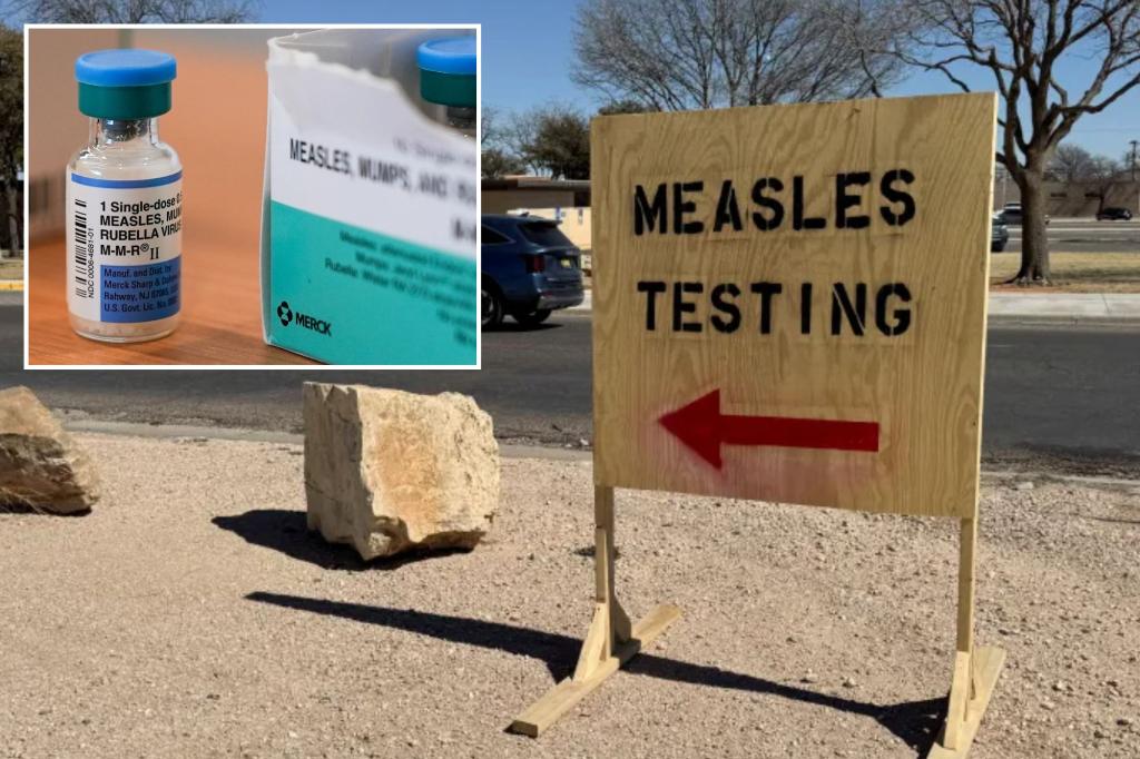Second child with measles has died in Texas, officials say