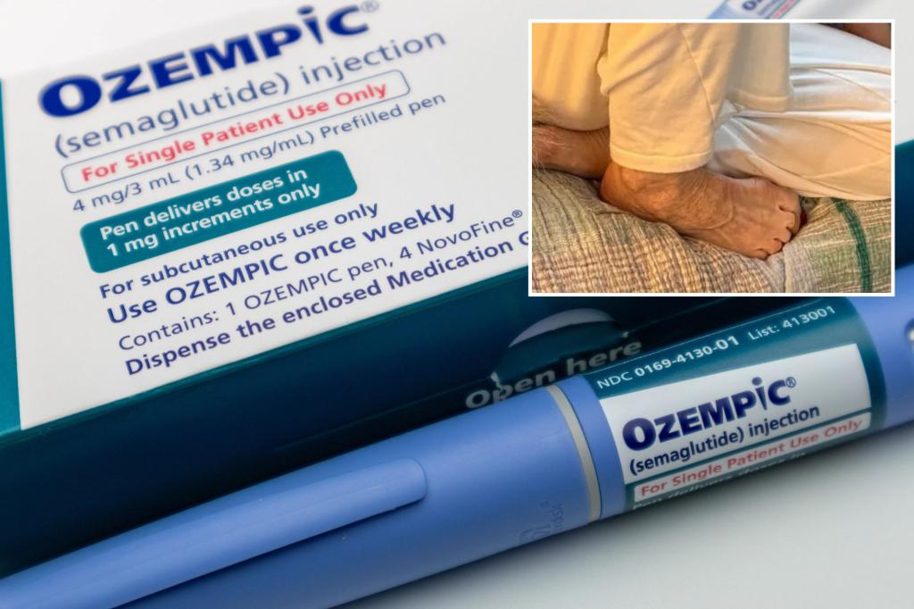 ‘Ozempic feet’ gnarly side effect of weight loss drug exhibited by some celebs: report
