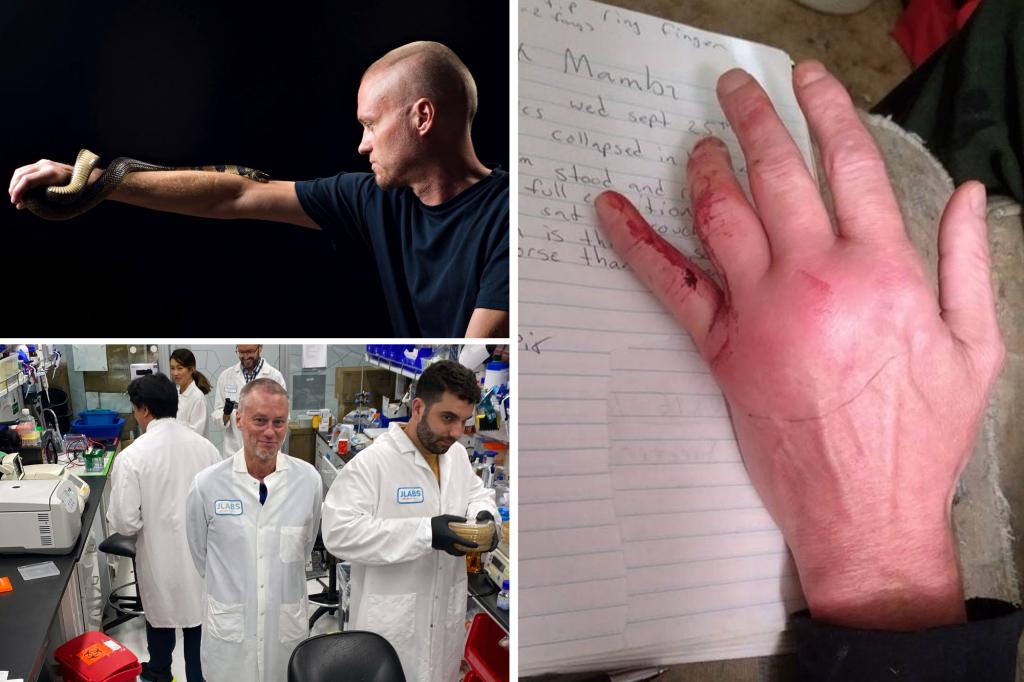 Tim Friede’s blood used to make universal anti-venom after snake bites