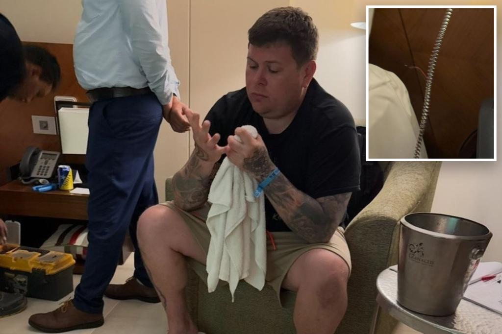Tourist ‘nearly burnt alive’ after electric shock runs through his teeth fillings at five-star resort