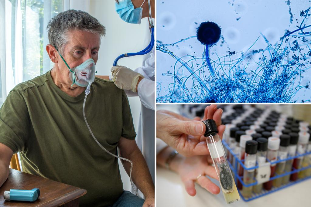 Dangerous fungus Aspergillus could spread to parts of US, researchers claim