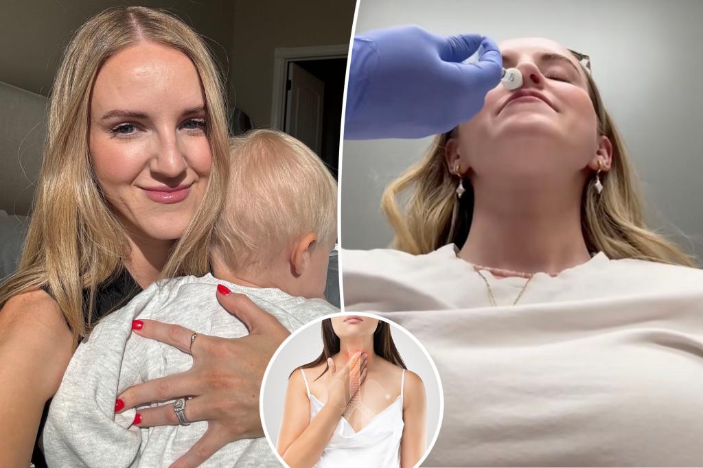 I’ve never been able to burp — now I’m getting burp surgery