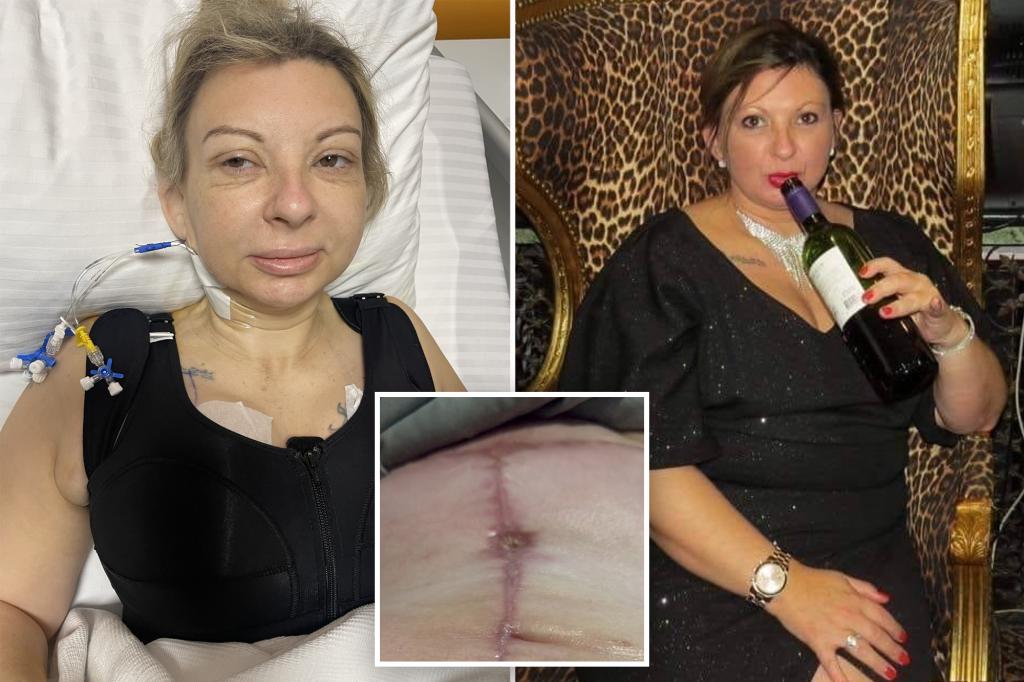 I spent K on a ‘mommy makeover’ in Turkey — it’s my life’s ‘biggest regret’