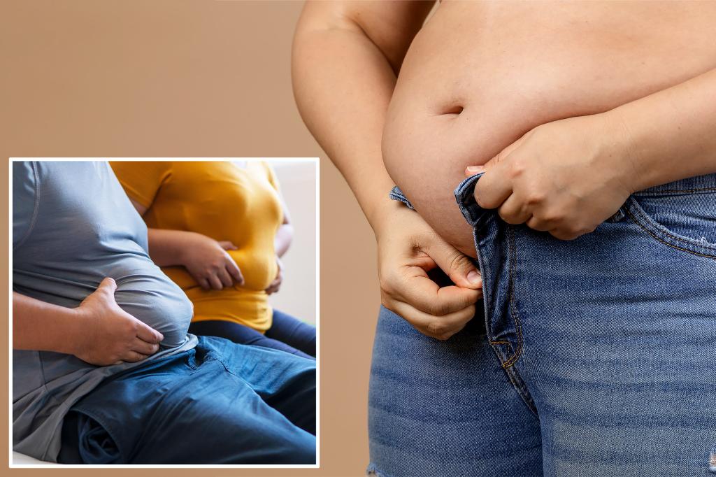 Excess belly fat has ‘surprising’ link to chronic skin condition: study