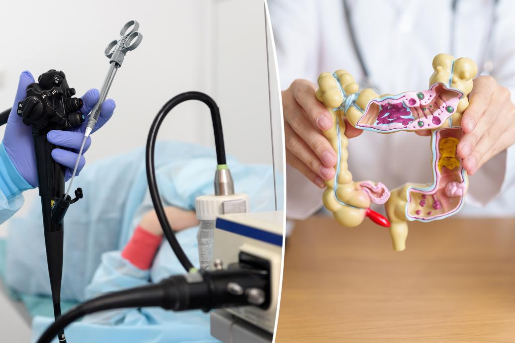 Single habit can cut colorectal cancer death risk by 39%