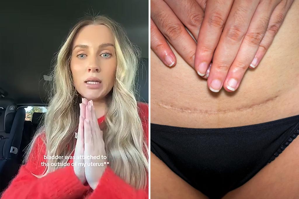 ‘There’s a baby in there. But it’s dead:’ mom shares horrific story