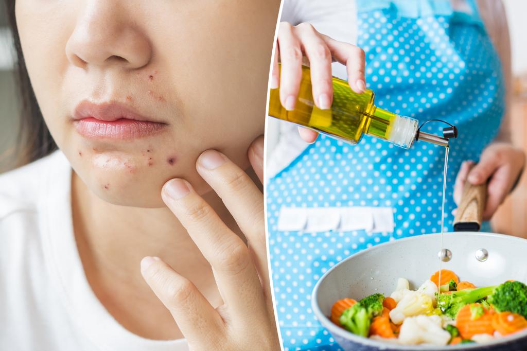 Common cooking mistake could be making you break out — it’s not your diet