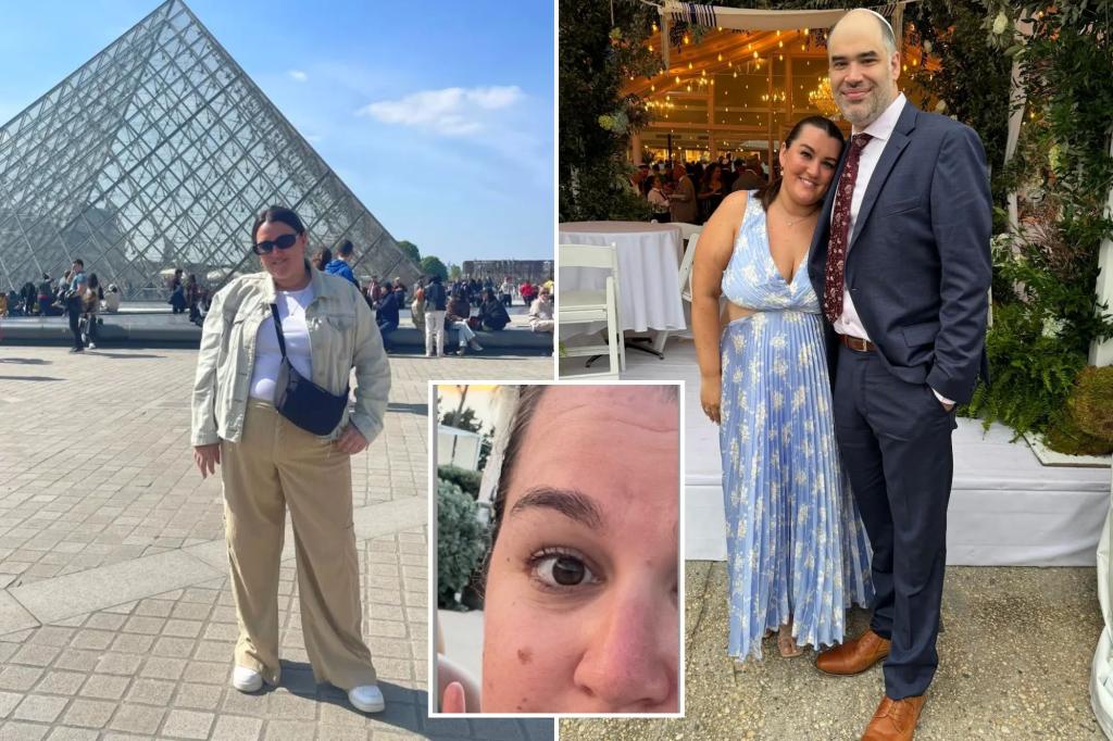 Doctors dismissed my mole — how I knew it was skin cancer